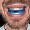 Housesafe -  Anti-Schnarch-Schiene (Zahnschutz)